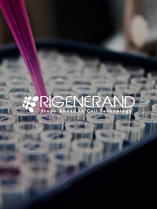 Rigenerand